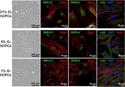 Human Cardiac Progenitor Cells Enhance Exosome Release and Promote Angiogenesis Under Physoxia